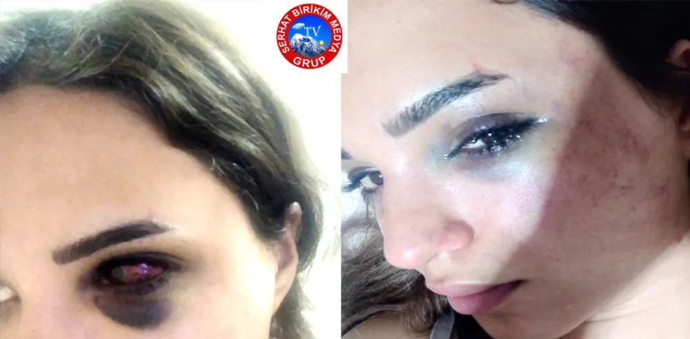 Leyla Akay: ölmek istemiyorum Can güvenliğim Kalmadı,